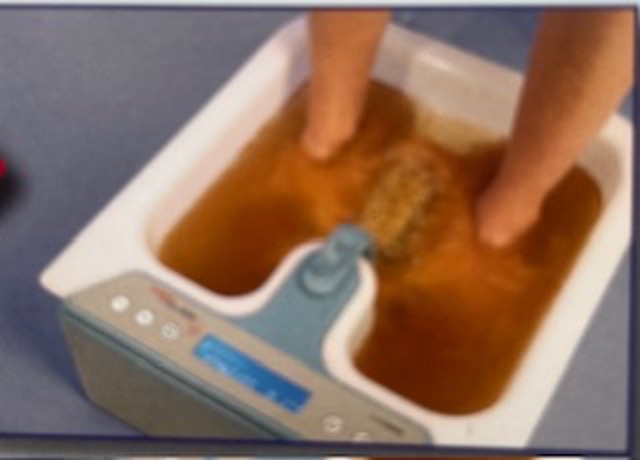 Foto hier: nach ca. 30 Minuten Behandlungszeit